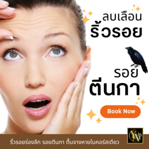 ลบเลือนริ้วรอย 1.30 ชม.
